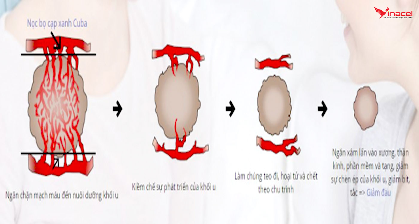 Labiofam Vida Plus Có Tốt Không?