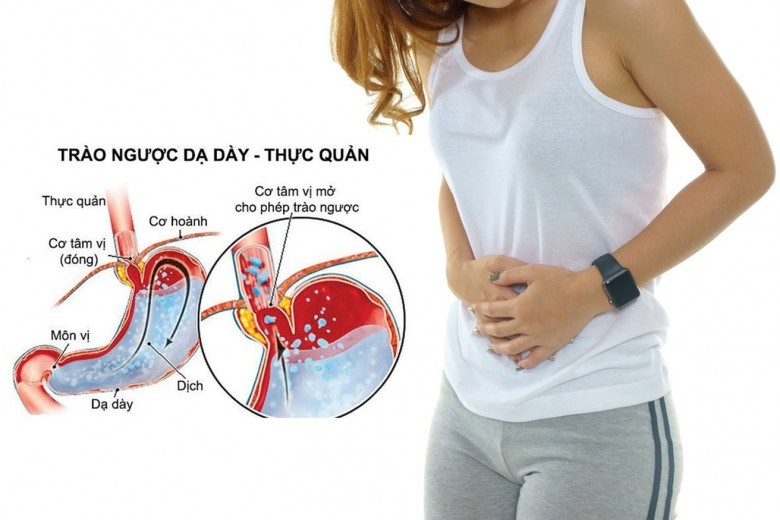 Nguyên nhân và tác hại của trào ngược dạ dày thực quản