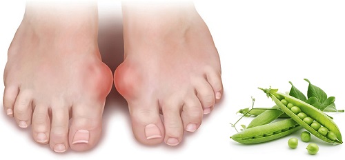 Cách chữa bệnh gout bằng đậu xanh