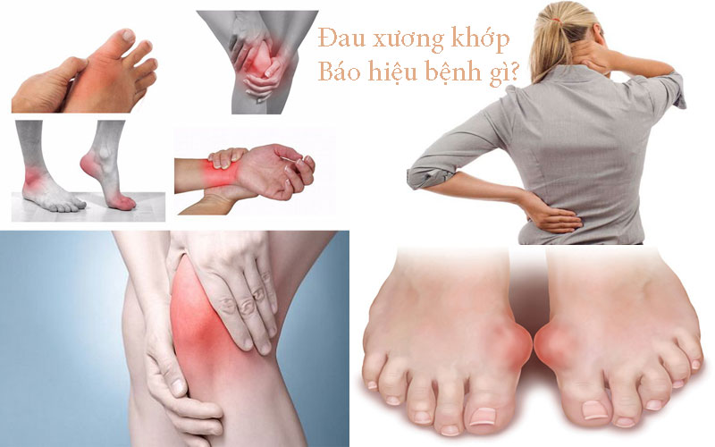 Đau xương khớp là dấu hiệu cảnh báo bệnh gì?