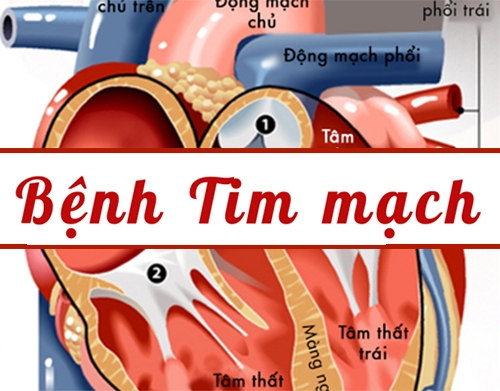 Bệnh tim mạch là gì?