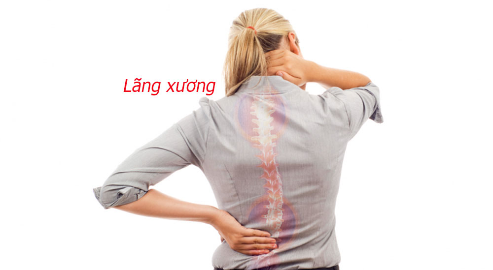 Nguyên nhân của bệnh loãng xương?