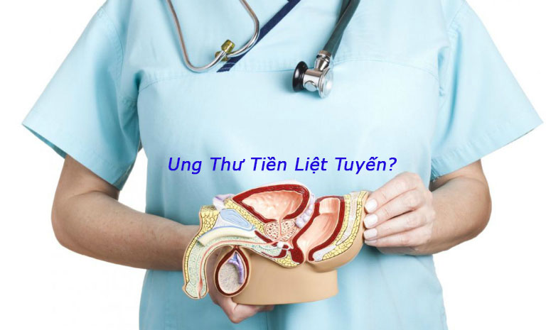 Những điều cần biết về bệnh ung thư tiền liệt tuyến