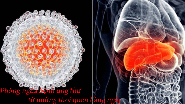 Phòng ngừa bệnh ung thư từ những thói quen hàng ngày