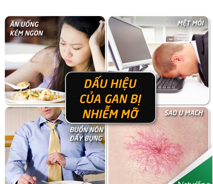 Những triệu chứng thường gặp khi bị suy giảm chức năng gan?