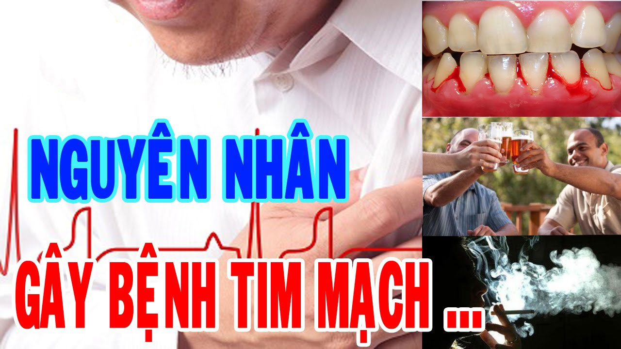 Nguyên nhân gây bệnh tim mạch?