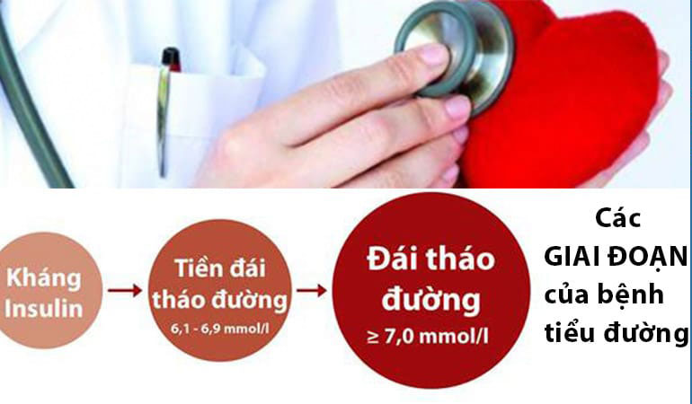 Những giai đoạn phát triển của bệnh Tiểu Đường?