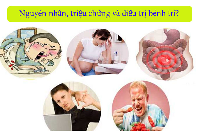 Nguyên nhân, triệu chứng và điều trị bệnh trĩ?