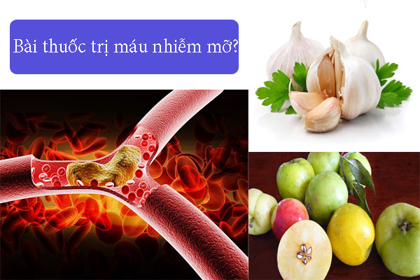 Bài thuốc trị máu nhiễm mỡ đơn giản hiệu quả tại nhà?