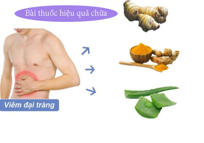 Bài thuốc dân gian chữa bệnh viêm đại tràng hiệu quả?