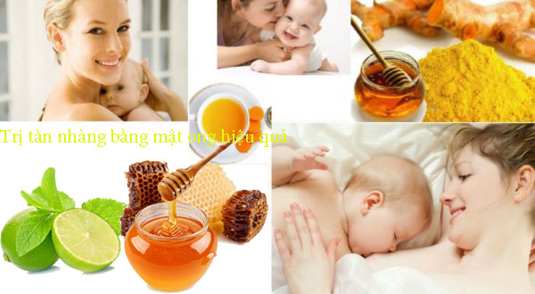 Bí quyết trị tàn nhang sau sinh tận gốc bằng mật ong