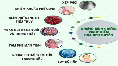 Biến chứng hen phế quản, hen suyễn? 