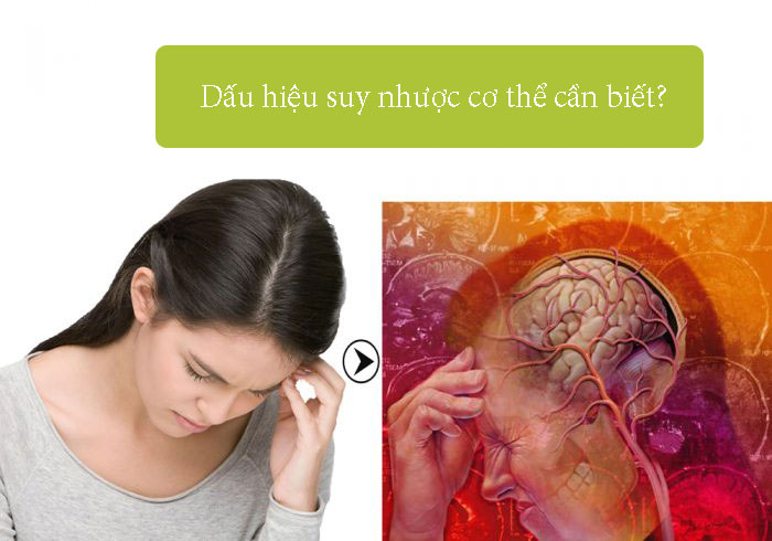 Những dấu hiệu suy nhược cơ thể nhiều người nên biết?