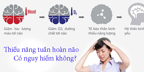 Thiểu năng tuần hoàn não có nguy hiểm không?