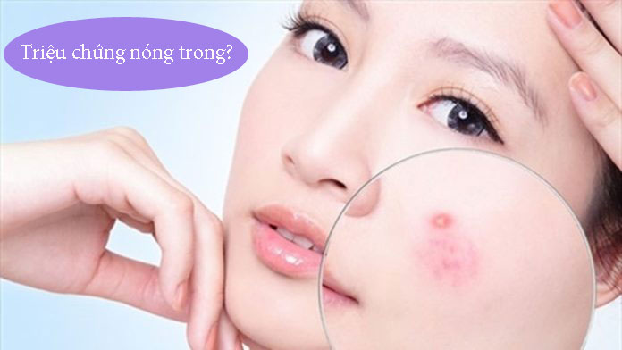 Triệu chứng nóng trong người cần chú ý?