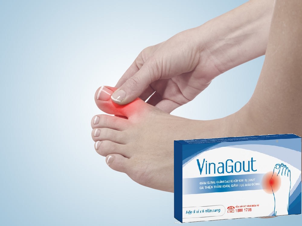 Viên uống Vina Gout mua ở đâu, giá bao nhiêu, có tốt không?