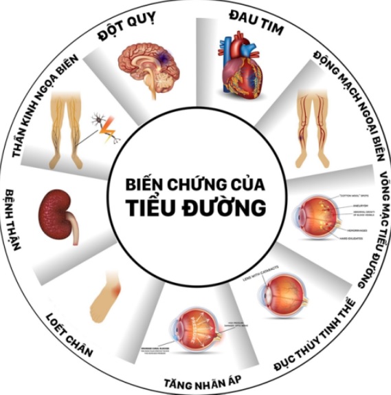 Dấu hiệu và biến chứng nguy hiểm của bệnh đái tháo đường