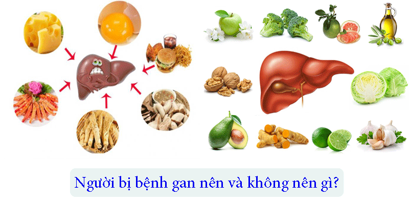 Người bị bệnh gan nên và không nên gì?