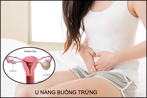 U nang là bệnh gì?