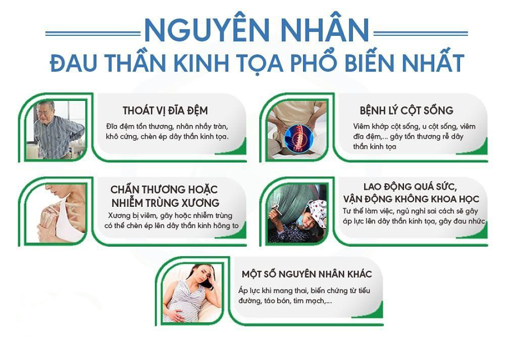 Nguyên nhân đau thần kinh tọa và cách điều trị hiệu quả