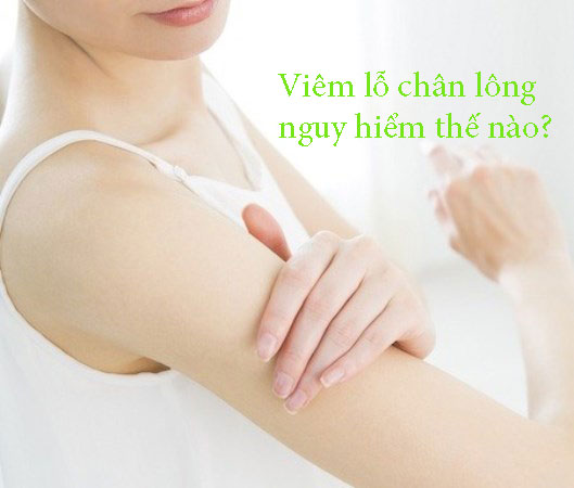 Viêm lỗ chân lông có nguy hiểm không?