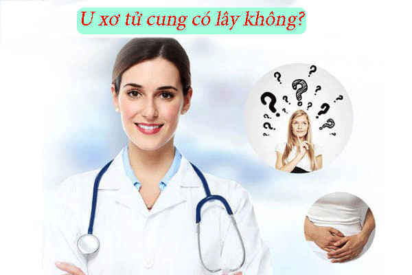 U xơ tử cung có lây không?