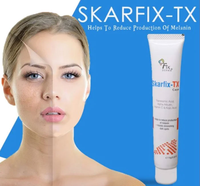 Kem dưỡng da mờ nám Fixderma Skarfix-TX Cream Hưng Lợi