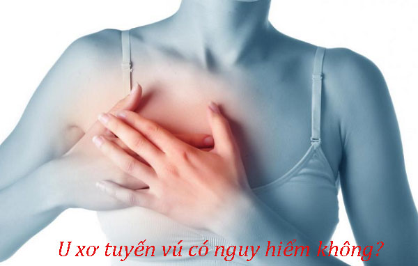 Bệnh u xơ tuyến vú có nguy hiểm không?