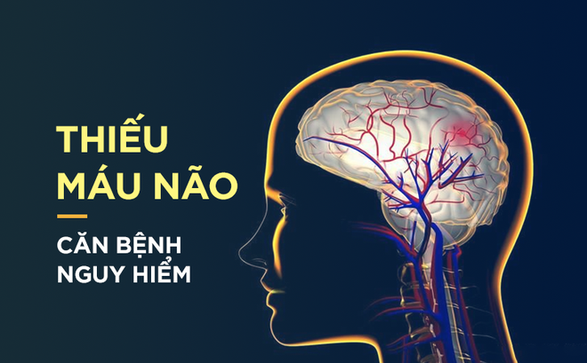 Nguyên nhân, dấu hiệu và cách điều trị thiếu oxy não