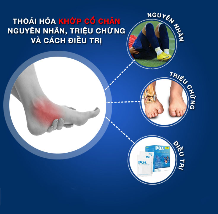 Nguyên nhân, triệu chứng và cách điều trị thoái hóa khớp?