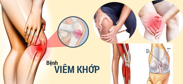 Cách giảm đau nhức xương khớp hiệu quả bất ngờ